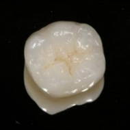 Цельноциркониевые коронки