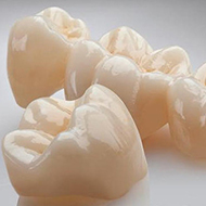 Керамика E-MAX на каркасе ZRO2