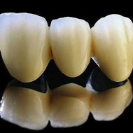 Цельнолитые и фрезерованные конструкции