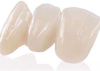 Безметалловая керамика E-MAX